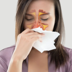 CONGESTIÓN NASAL